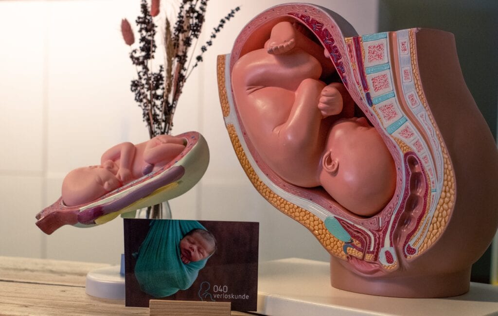 fantoom baby in buik